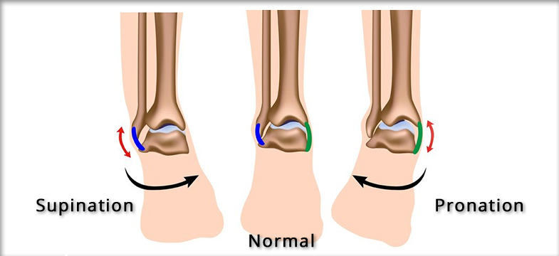 Pronation Supination Ueberpronation